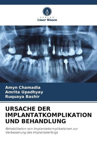 Produktbild: Ursache der Implantatkomplikation und Behandlung