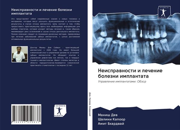 Produktbild: Neisprawnosti i lechenie bolezni implantata