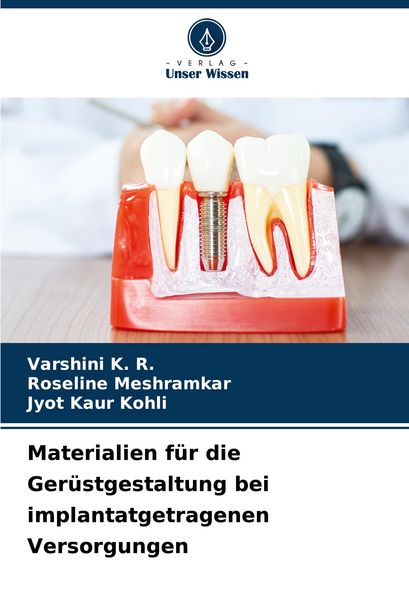 Produktbild: Materialien f&uuml;r die Ger&uuml;stgestaltung bei implantatgetragenen Versorgungen