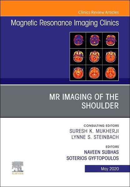 Produktbild: MR Imaging of the Shoulder, an Issue of Magnetic Resonance Imaging Clinics of North America