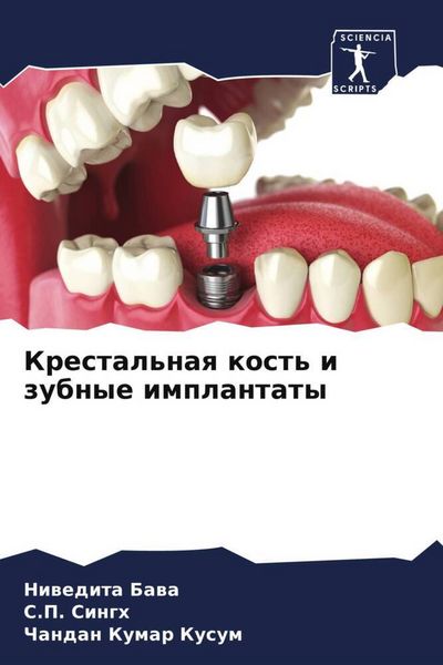 Produktbild: Krestal'naq kost' i zubnye implantaty