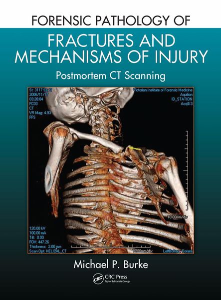 Produktbild: Forensic Pathology of Fractures and Mechanisms of Injury