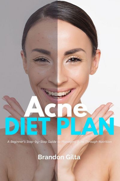 Produktbild: Acne Diet Plan