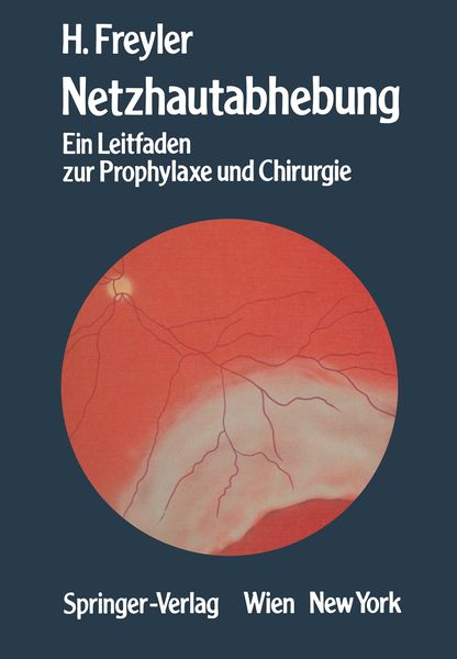 Produktbild: Netzhautabhebung