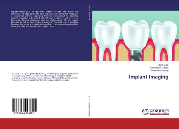 Produktbild: Implant Imaging
