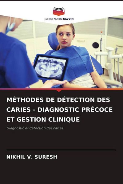 Produktbild: M&eacute;thodes De D&eacute;tection des Caries - Diagnostic Pr&eacute;coce Et Gestion Clinique
