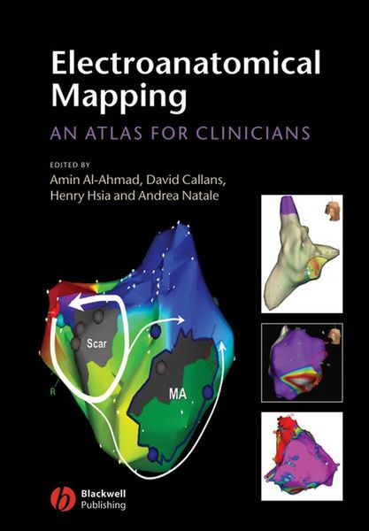 Produktbild: Electroanatomical Mapping