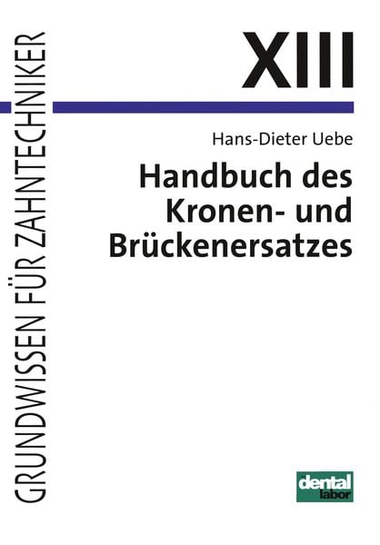 Produktbild: Handbuch des Kronen- und Br&uuml;ckenersatzes