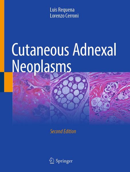 Produktbild: Cutaneous Adnexal Neoplasms