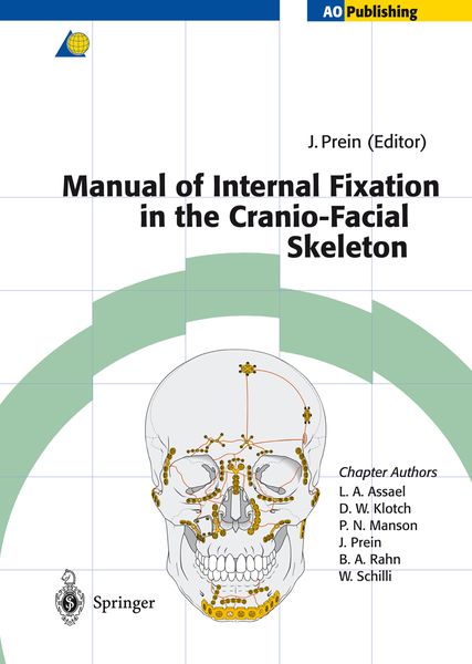 Produktbild: Manual of Internal Fixation in the Cranio-Facial Skeleton