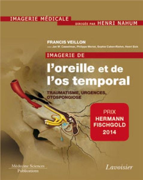 Produktbild: Imagerie de l'oreille et de l'os temporal vol 3 Traumatologie, urgence