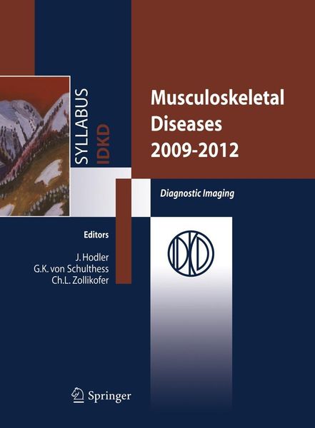 Produktbild: Musculoskeletal Diseases 2009-2012