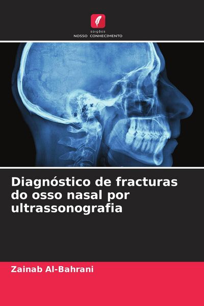 Produktbild: Diagn&oacute;stico de fracturas do osso nasal por ultrassonografia