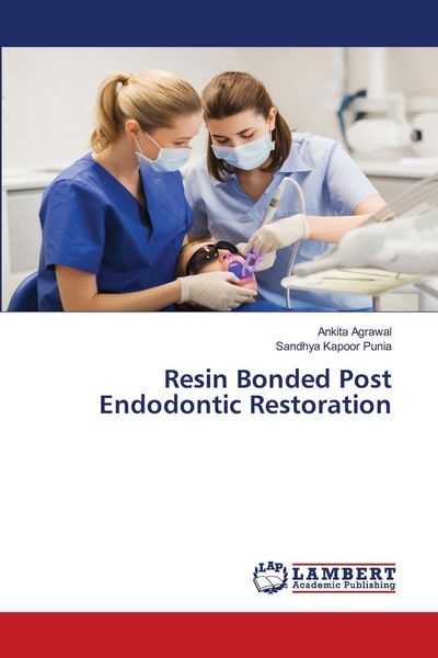 Produktbild: Resin Bonded Post Endodontic Restoration