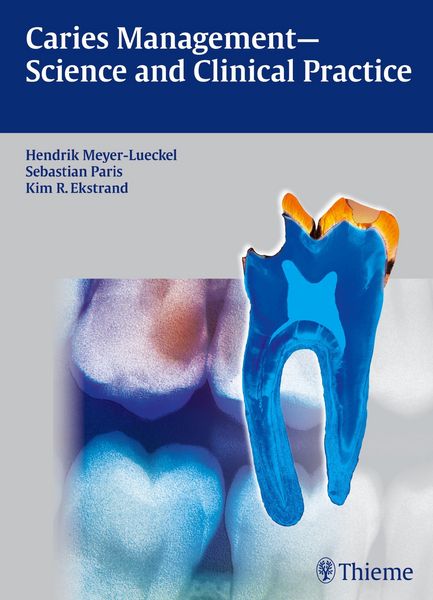 Produktbild: Caries Management - Science and Clinical Practice