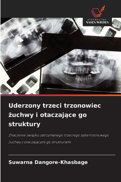 Produktbild: Uderzony trzeci trzonowiec &iquest;uchwy i otaczaj&iquest;ce go struktury