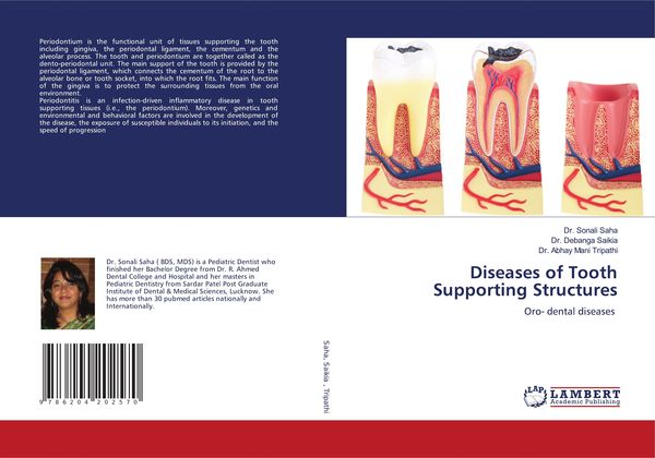 Produktbild: Diseases of Tooth Supporting Structures