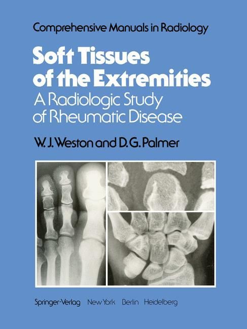 Produktbild: Soft Tissues of the Extremities