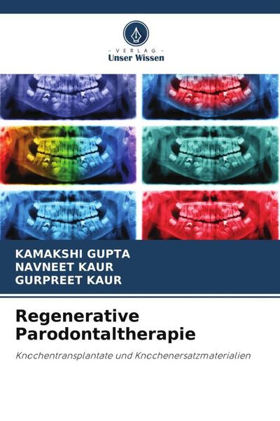 Regenerative Parodontaltherapie, Taschenbuch von Kamakshi Gupta , Navneet Kaur , Gurpreet Kaur, Verlag Unser Wissen, 9786204834238