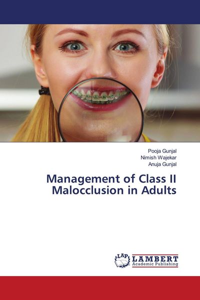 Produktbild: Management of Class II Malocclusion in Adults