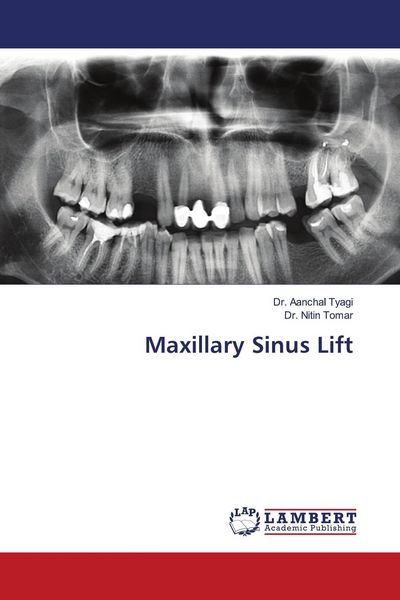 Produktbild: Maxillary Sinus Lift