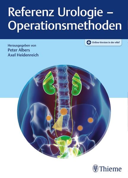 Produktbild: Referenz Urologie - Operationsmethoden