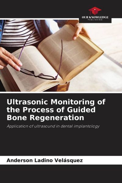 Produktbild: Ultrasonic Monitoring of the Process of Guided Bone Regeneration