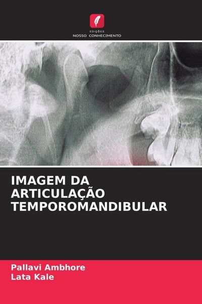 Produktbild: Imagem Da Articula&ccedil;&atilde;o Temporomandibular
