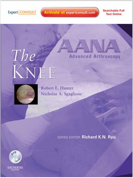 Produktbild: AANA Advanced Arthroscopy: The Knee E-Book