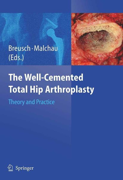 Produktbild: The Well-Cemented Total Hip Arthroplasty