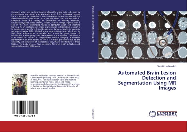 Produktbild: Automated Brain Lesion Detection and Segmentation Using MR Images