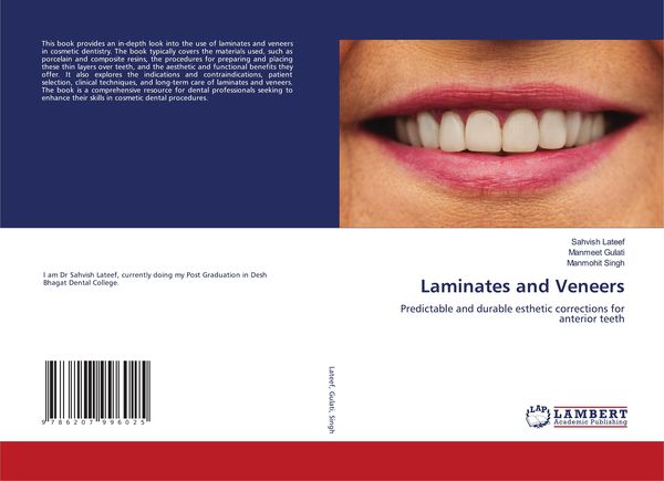 Produktbild: Laminates and Veneers