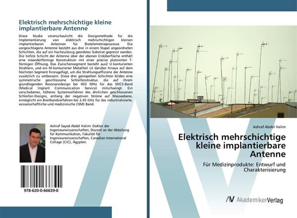Produktbild: Elektrisch mehrschichtige kleine implantierbare Antenne