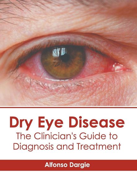Produktbild: Dry Eye Disease: The Clinician's Guide to Diagnosis and Treatment