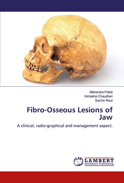 Produktbild: Fibro-Osseous Lesions of Jaw