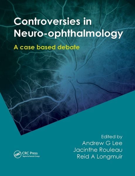 Produktbild: Controversies in Neuro-Ophthalmology