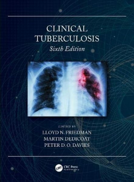 Produktbild: Clinical Tuberculosis 6/e