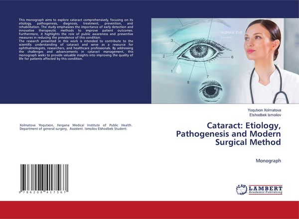Produktbild: Cataract: Etiology, Pathogenesis and Modern Surgical Method