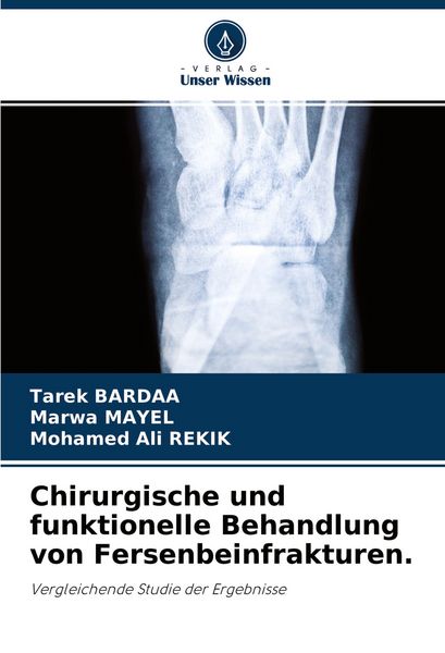 Produktbild: Chirurgische und funktionelle Behandlung von Fersenbeinfrakturen.
