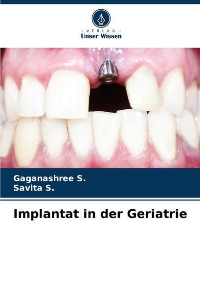 Produktbild: Implantat in der Geriatrie