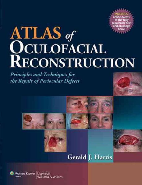 Produktbild: Atlas Of Oculofacial Reconstru
