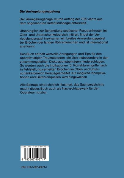 Produktbild: Die Verriegelungsnagelung
