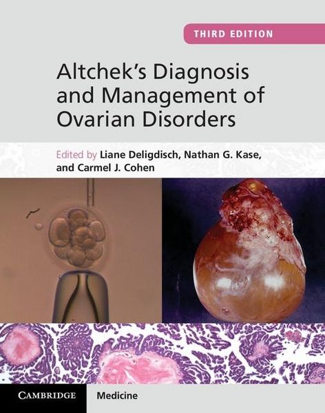 Produktbild: Altchek's Diagnosis and Management of Ovarian Disorders