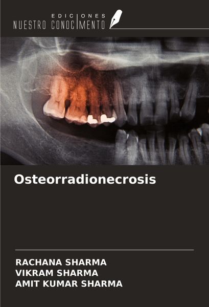 Produktbild: Osteorradionecrosis