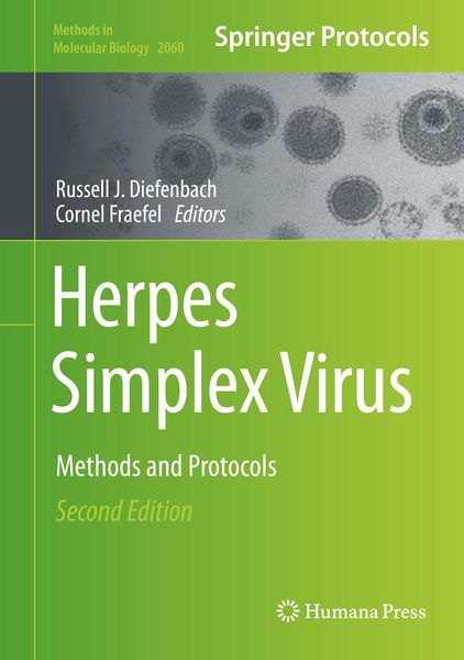 Produktbild: Herpes Simplex Virus