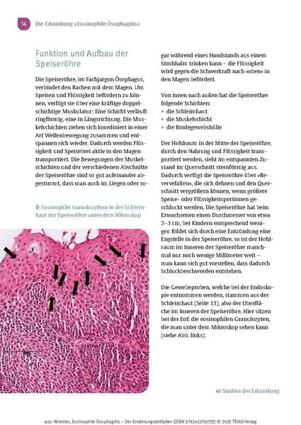 Produktbild: Eosinophile &Ouml;sophagitis - Der Ern&auml;hrungsleitfaden