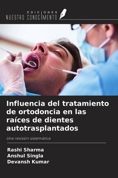 Produktbild: Influencia del tratamiento de ortodoncia en las ra&iacute;ces de dientes autotrasplantados