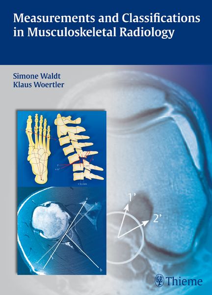 Produktbild: Measurements and Classifications in Musculoskeletal Radiology