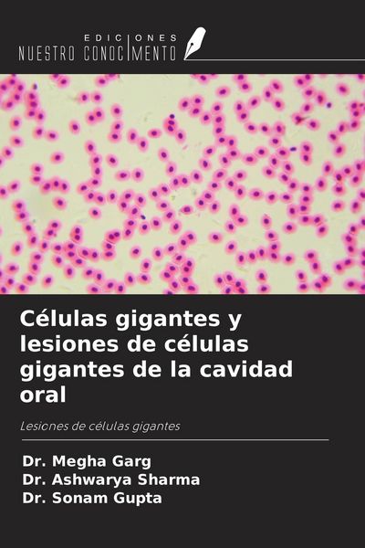 Produktbild: C&eacute;lulas gigantes y lesiones de c&eacute;lulas gigantes de la cavidad oral