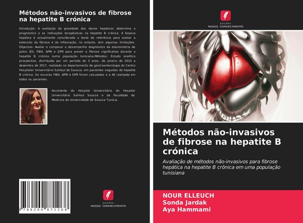 Produktbild: M&eacute;todos n&atilde;o-invasivos de fibrose na hepatite B cr&oacute;nica